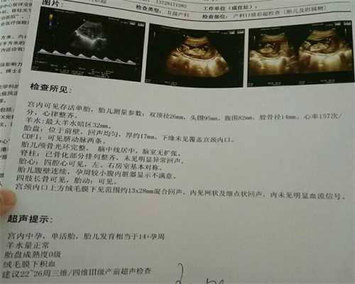 云南私立医院做试管婴儿步骤