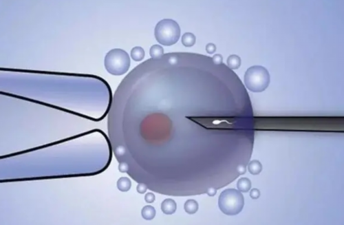 试管代生费用明细与成功率解析