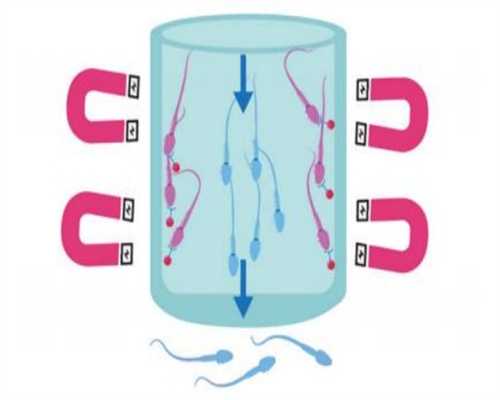 轻微卵巢囊肿是否适合试管婴儿治疗及注意事项
