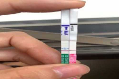 双角子宫是否适合进行试管婴儿治疗