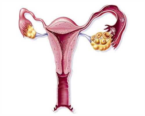 如何自测精子质量，三点方法辨别健康与否