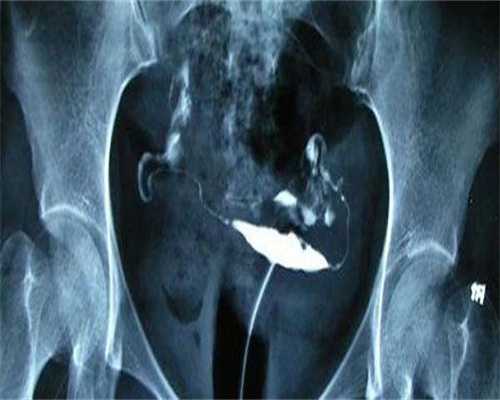 北京第三代试管医院选择指南：费用与成功率解析